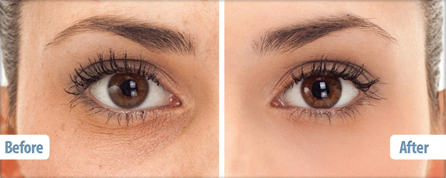 Kem chống nhăn, thâm vùng da mắt Obagi ELASTIderm Eye Treatment Cream15g được ưa chuộng hàng đầu tại Mỹ-hibeauty