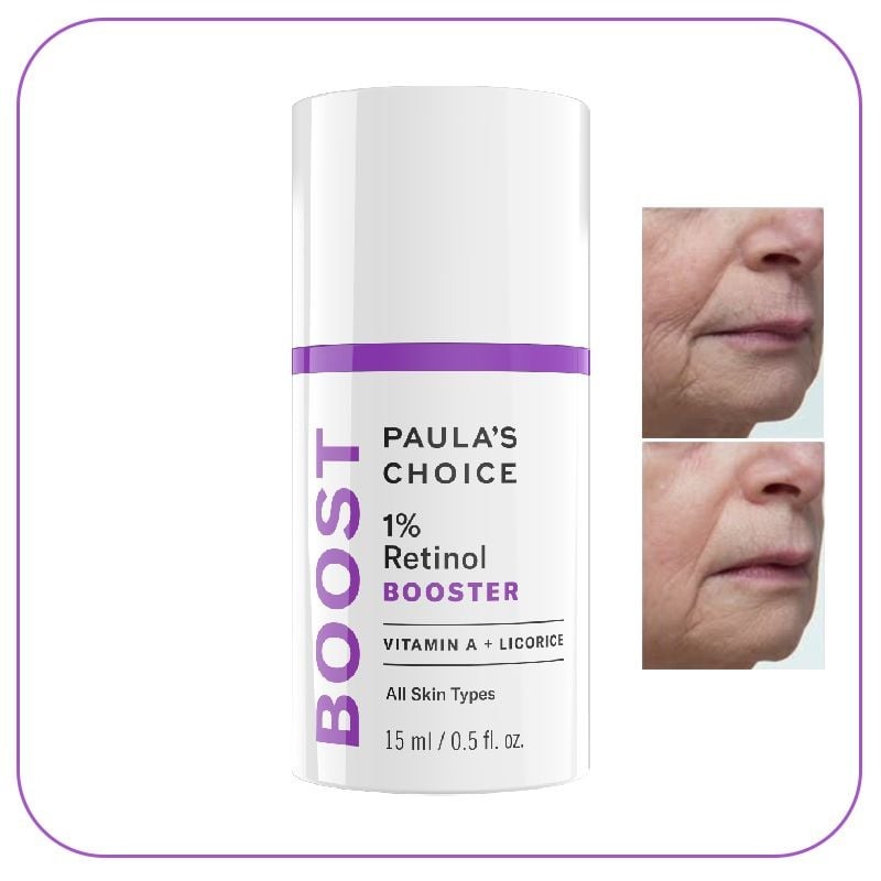bo_tron_c95ee3724bec4df59f686324 (1)