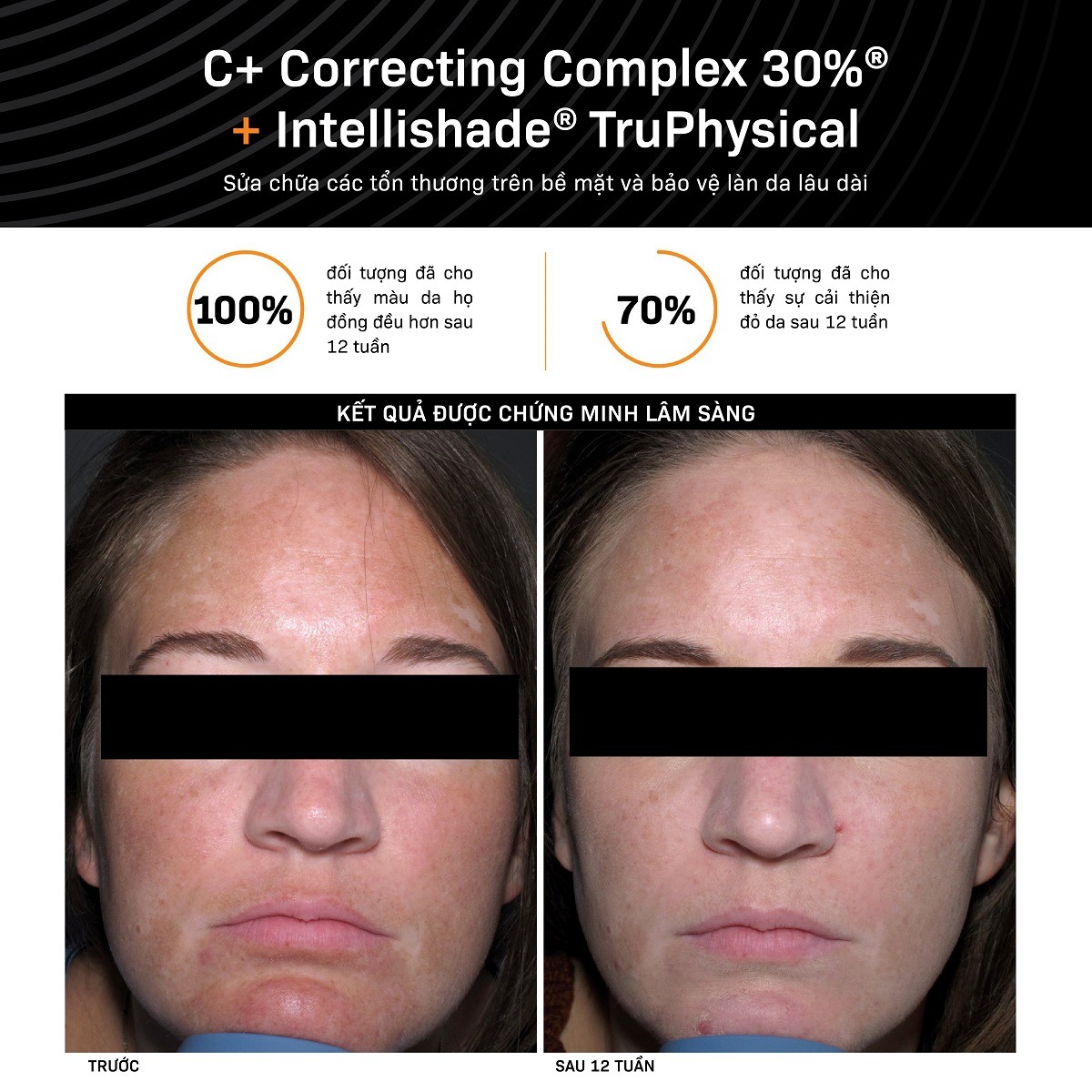 RS-T11-08-C-01