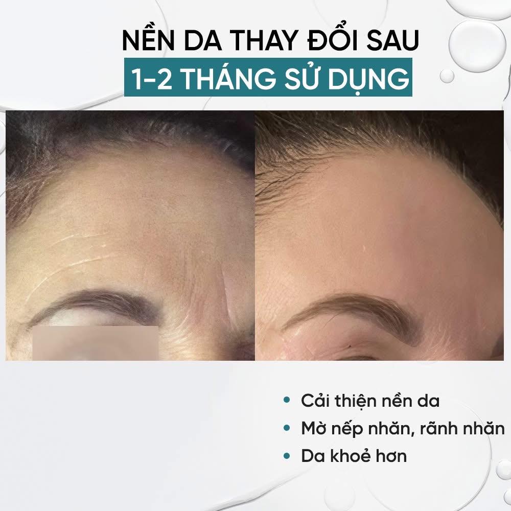 AnteAGE MD Biosome Serum (1)