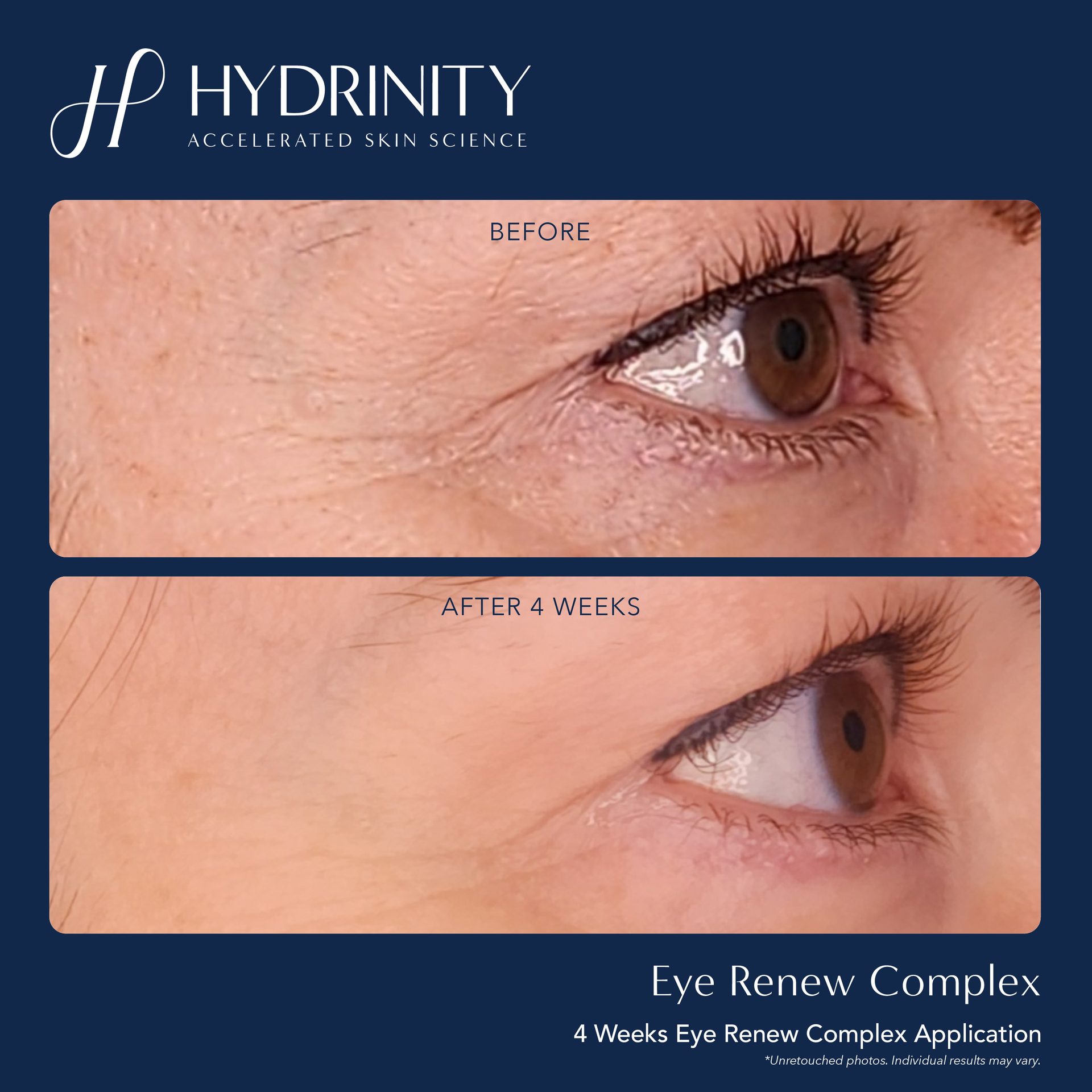 Hydrinity Eye Renew Complex (2)