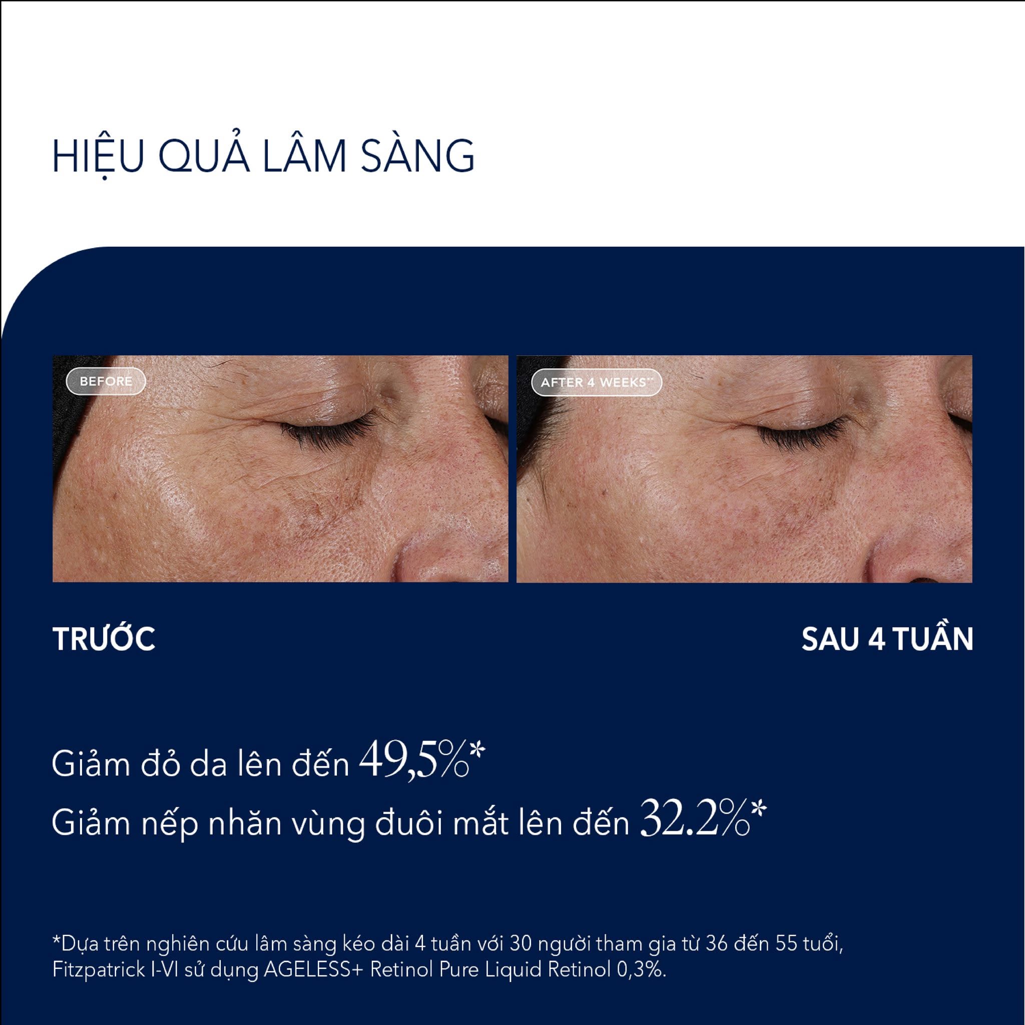 Image AGELESS+ Retinol Pure Liquid Retinol 0 (10)