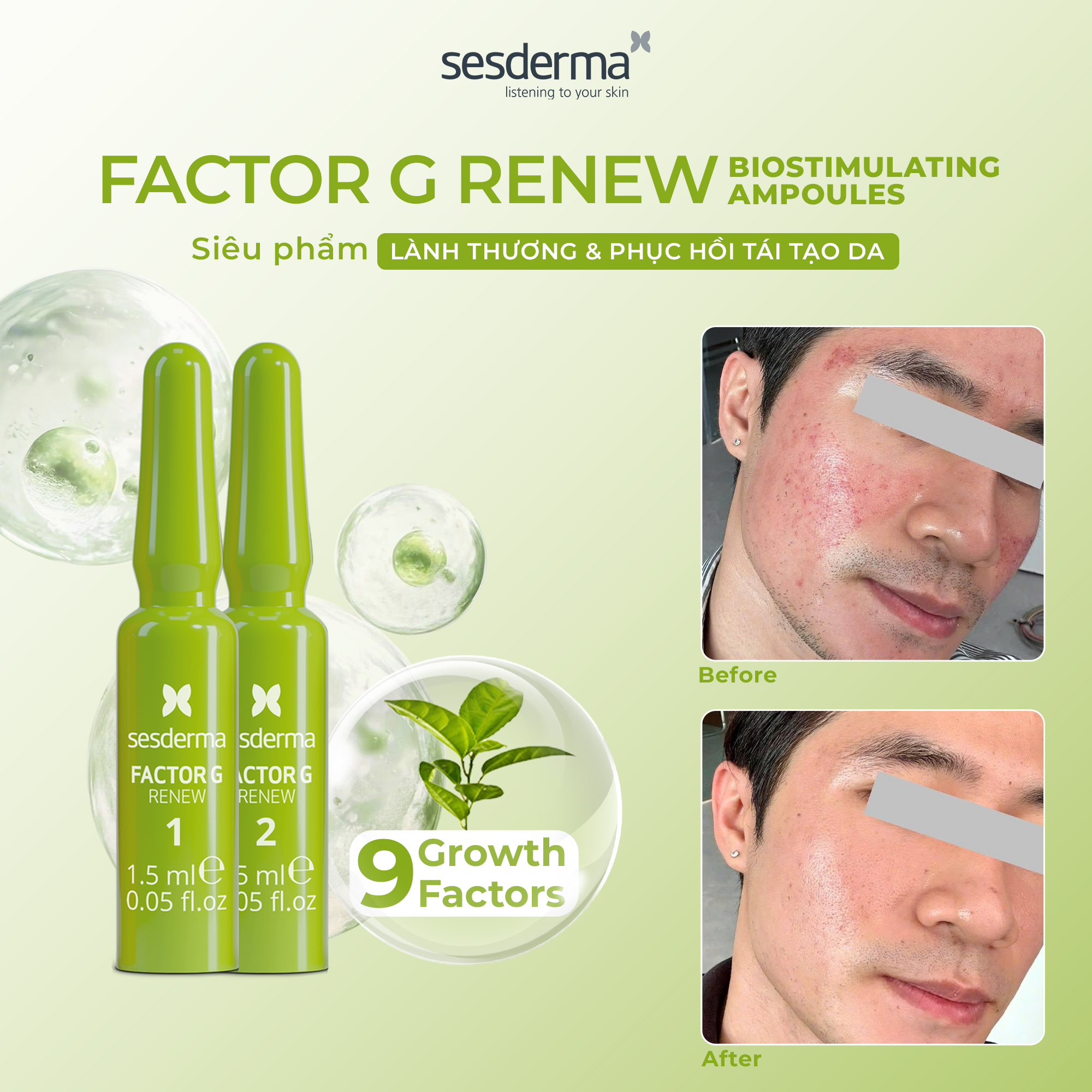 Sesderma Factor G Renew Biostimulating Ampoules (1)