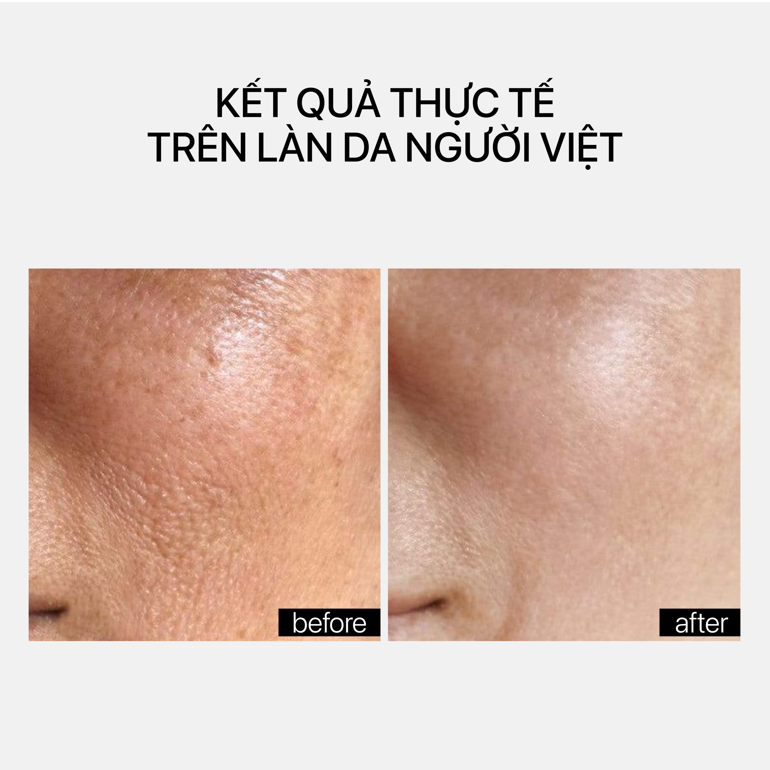 Transparent Lab Gentle Rejuvenation Serum (5)